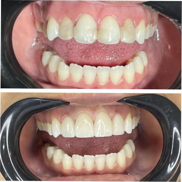 saveclip_app_261715738_443420423843415_945300816636825789_n