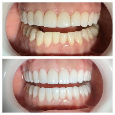 saveclip_app_263237063_1078933046271444_2261113504298058085_n