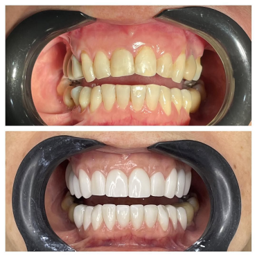 saveclip_app_277032432_159763839766481_2180637626178439876_n